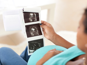 woman looking at ultrasound photos