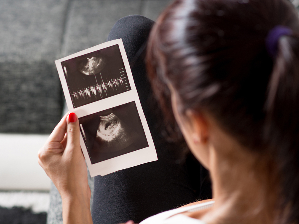 woman looking at ultrasound photo