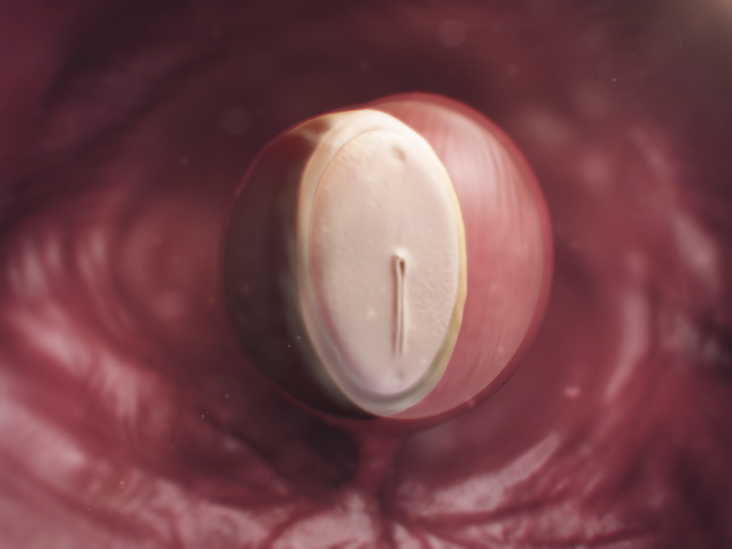 embryo made up of hypoblast and epiblast